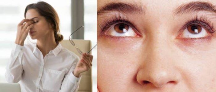 5 Eye Exercises to Improve Eyesight