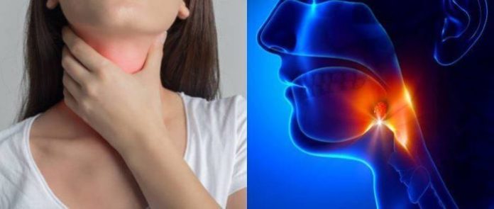 Tonsils Symptoms, Causes and Home Remedies