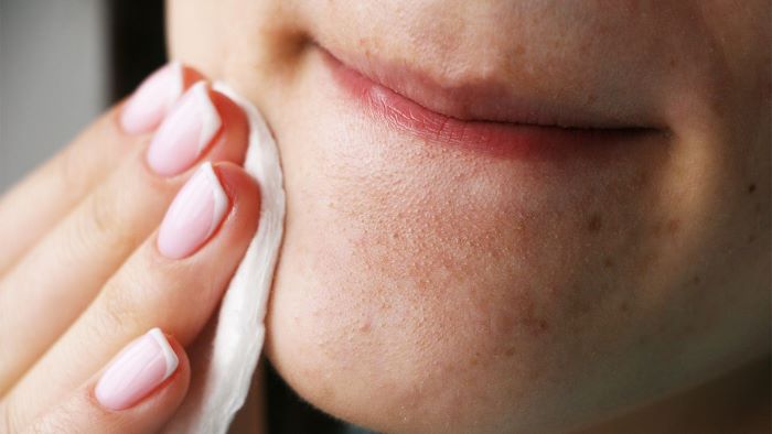 While Removing Blackheads Avoid These Mistakes