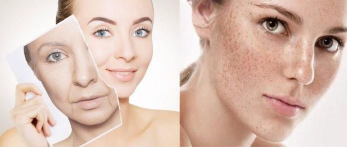 Effective Home Remedies to Remove Wrinkles and Freckles from Face