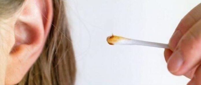 How to Remove Ear Wax Home Remedies