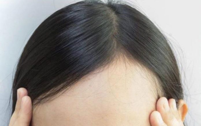 Easy Tips to Cover Receding Hairline with Makeup and Bangs
