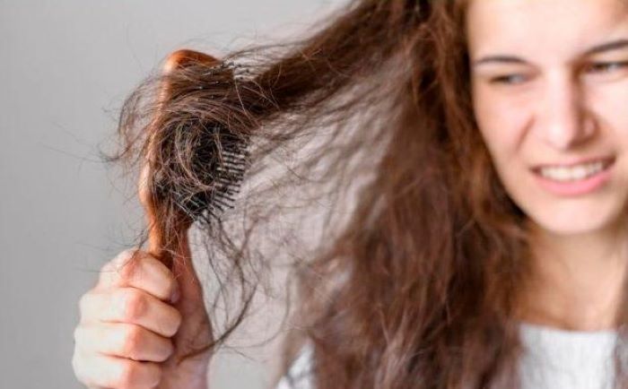 Common Reasons of Hair Fall in Women Above 30