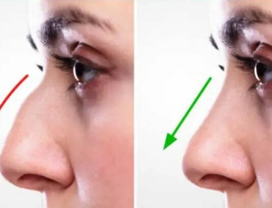 How To Get The Perfect Nose Exercises