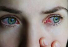 Home Remedies For Eye Infection